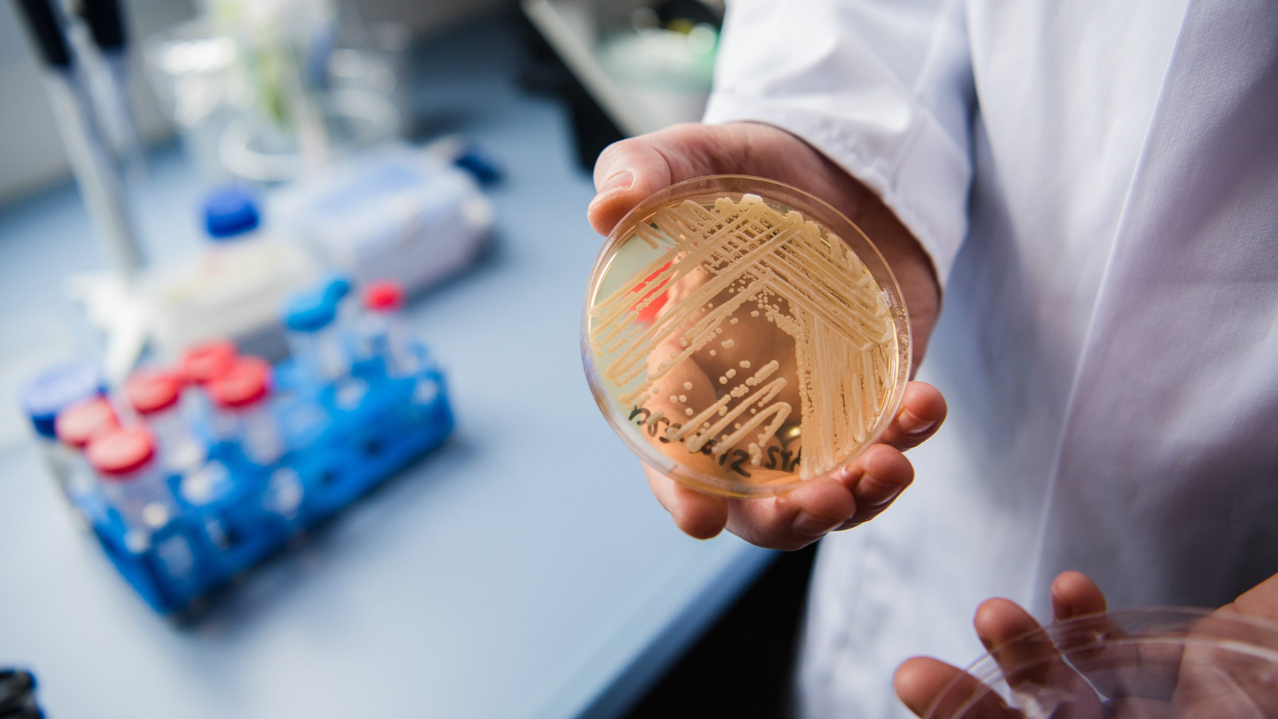 New study reveals why dangerous fungus is so difficult to treat — KTVU FOX 2 Bay Area, Woodside Community news